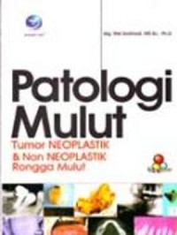 Patologi mulut : tumor neoplastik & non neoplastik rongga mulut
